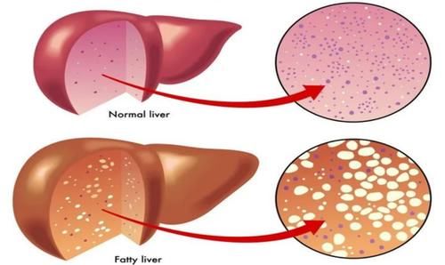 氢化植物油|医生：肝不好的人，建议多吃3种水果，牢记2个方法，或有利于养肝
