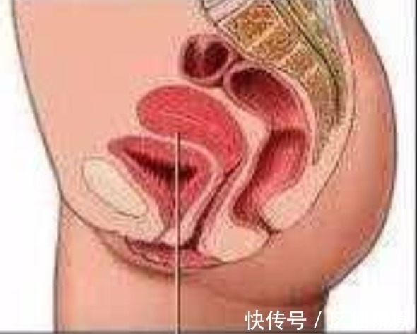 何生|27岁孕妈顺产15天后,上厕所掉出“一块肉”,医生说太晚了