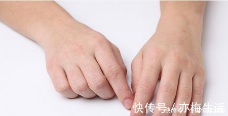 雌激素|长寿的女性,往往手上会有“表现”,若你也有,可能也会长寿