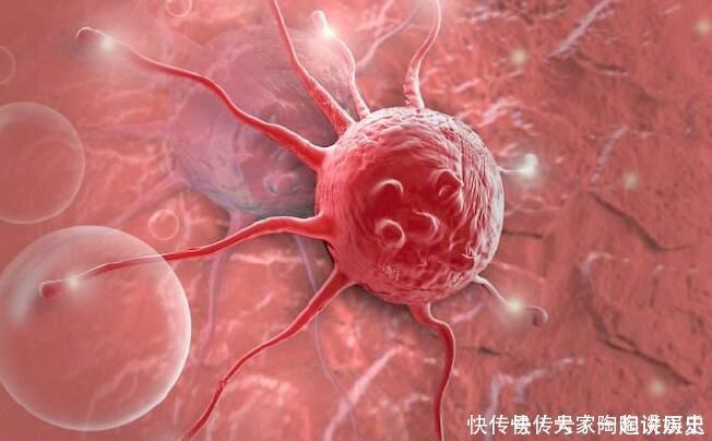 癌细胞|这些是癌症中常见的一些信号, 有一个, 你就需要当心了!