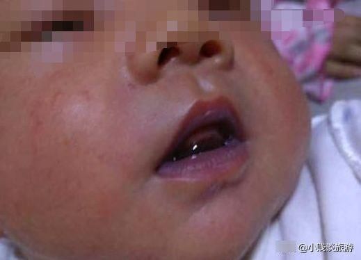 醒来|宝宝在满周岁的酒席上睡着了,直到散场也没醒,结果再也无法醒来