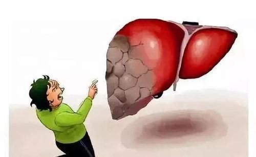 代谢|肝不好,与吃大蒜有关?若想肝脏健康,医生建议:还是少碰这2物