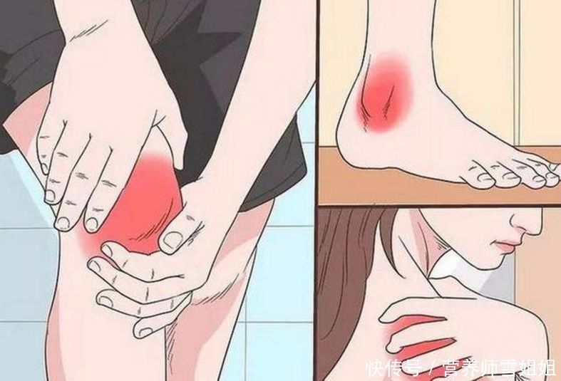 一旦查出尿酸高,少碰二物,改掉三习,做好四事,稳降尿酸少痛风