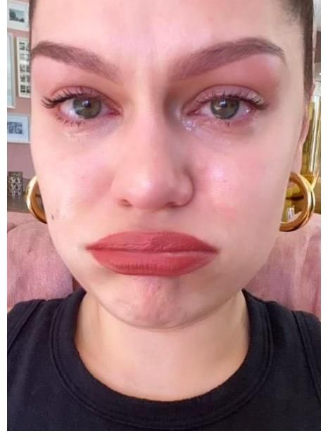 结石|Jessie J 更新病情,没有一天不痛,结石姐这些年,真让人心疼