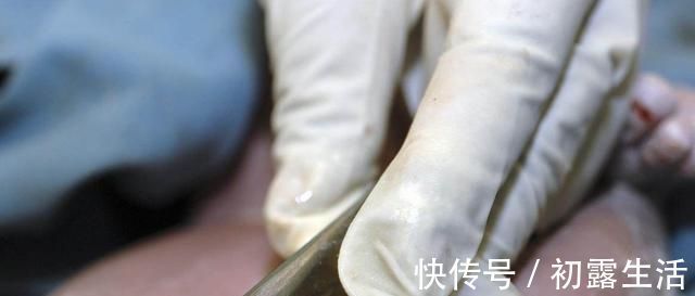 孩子|38岁孕妈剖腹产全过程用命换来的孩子,还不值一万块钱