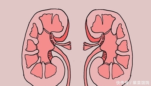 身体|排尿很黄，异味很大？多半是身体发出“求救信号”，别以为是上火