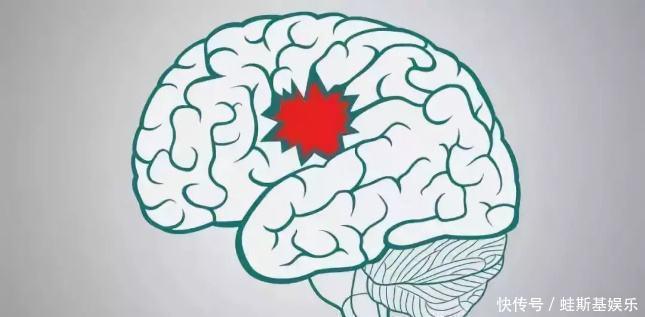 警惕!痴呆已成中老年健康的“第4大杀手”若想躲开,做好4件事