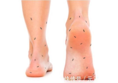 下肢|如果发现自己的腿脚出现以下几个症状,要小心糖尿病足找上门来!