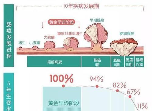 中晚期直腸癌 別急著先做手術 選擇有問題生存時間能好嗎 中國熱點
