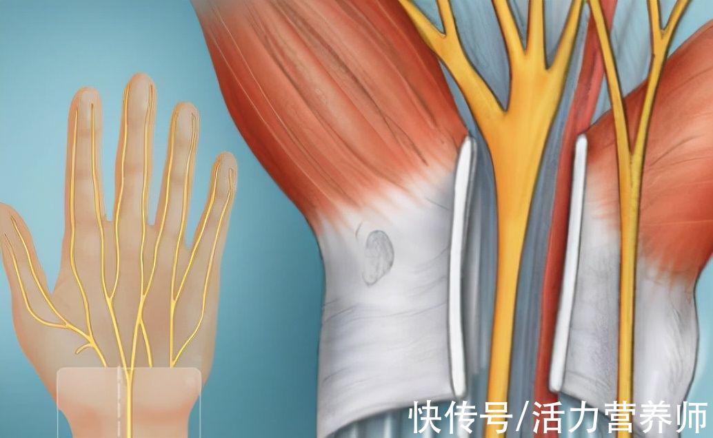 视力障碍|手指发麻是颈椎病吗?今天教你3个简单的判断办法,及时避免