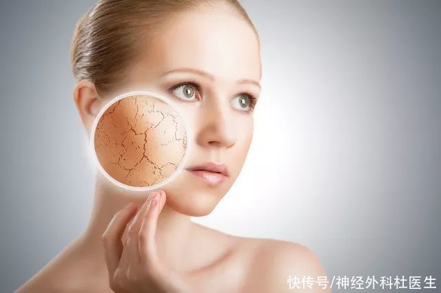 苯妥英|长斑的人谨记，3种食物不要碰！常吃黑素堆积，满脸色斑