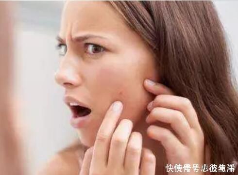 秘诀|去痘印的秘诀:平时做好4件事远离3种食物,帮你解决烦恼
