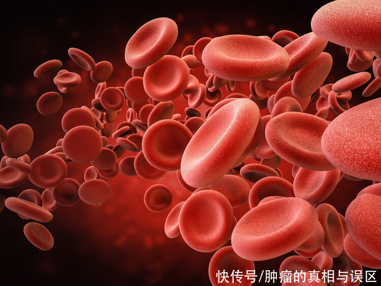 胃癌|国外研究表明:血型暴露了患癌风险,2种血型的人要注意了