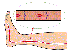 第一附属医院|身体这些部位「青筋凸起」,可能是救命体征