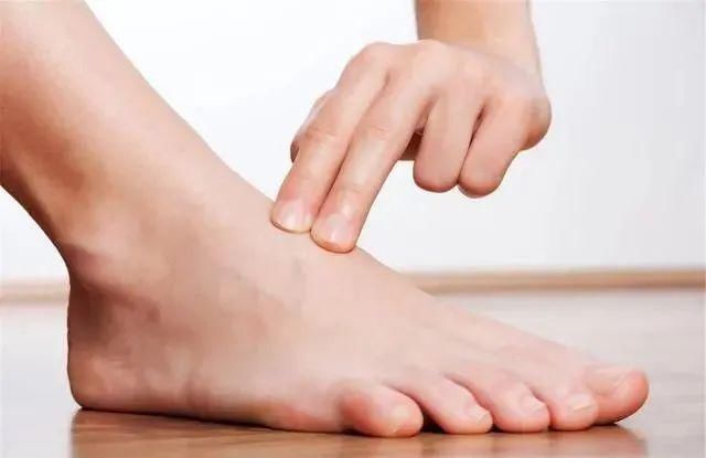 高血糖|血糖超标,“脚”知道?双脚若没有4异常,祝贺,血糖控制得不错