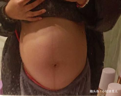 孕期|准妈妈做四维彩超,被医生训斥胎儿没了你不知道吗