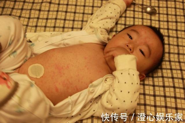 护理|宝宝出现9个特点,可能是患急疹了,教你5个方法,在家就能护理