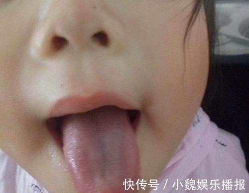 医生|2岁宝宝脾胃虚不吃饭，医生检查后，才知是这三种辅食“惹的祸”