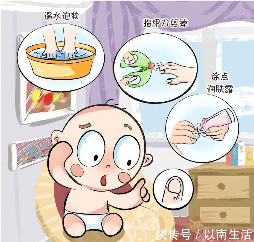 爸妈|倒刺、白斑，这还是宝宝的小指甲吗？要紧吗？宝宝指甲问题大汇总