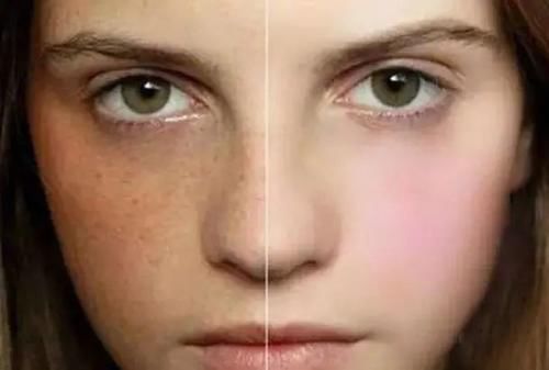 一天到晚总是放屁，别忽视，或许不是肠胃问题