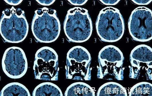 ct|总是头晕怎么办?脑供血不足检查能查出来吗?一次性给你讲清楚!