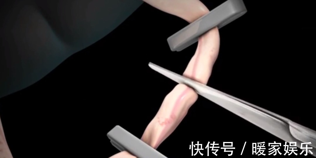 不容易|顺产到底有多疼8张图片告诉你女人顺产有多不容易