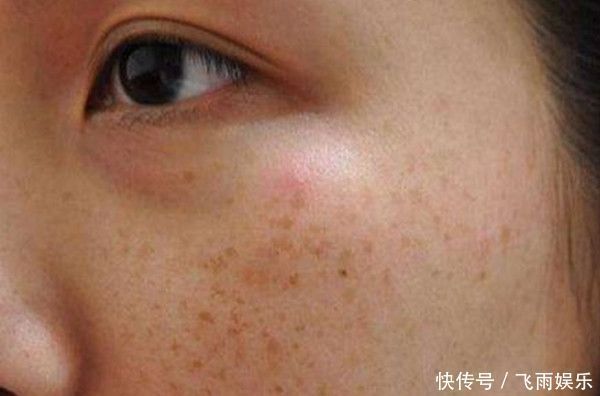 小小桑叶,大有用途,坚持泡水喝,4大好处会让你“开心不已”