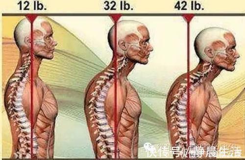 颈椎|颈椎安康:得了颈椎病不要怕,四个防护方法助您保护您的颈椎