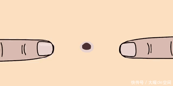 鼻子不干净都是黑头,医生,不是黑头是脂质微丝