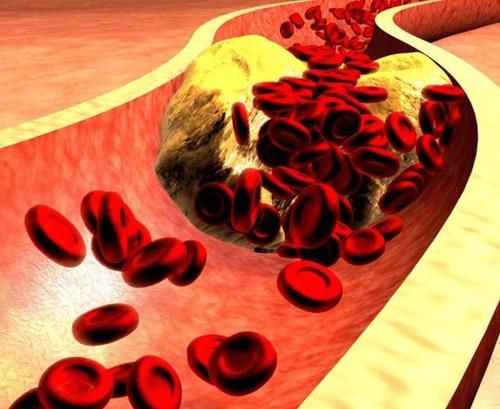 甘油三酯|想要稳定甘油三酯，中老年人尽量远离这3物要，早了解早受益