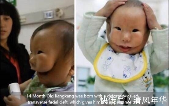 妈妈|宝宝安全出生,可妈妈看到宝宝的样子失声痛哭!