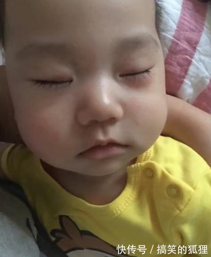 积食|宝宝2个地方“变化”，说明严重积食了，冬季带娃，谨记3多2少