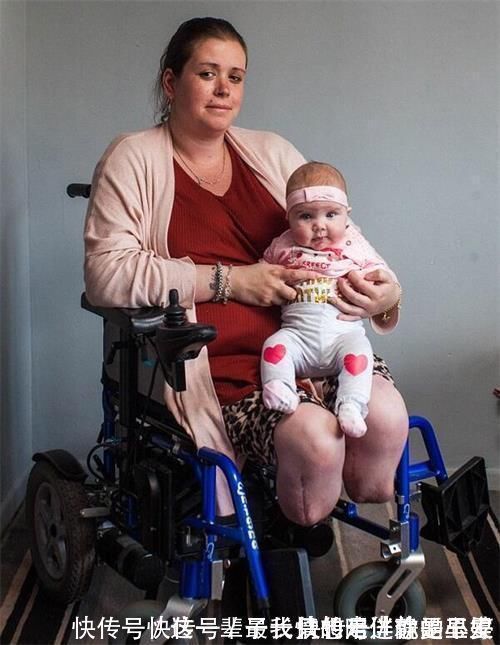 小宝宝|生下孩子醒来却发现自己的腿不见了!这是什么操作!