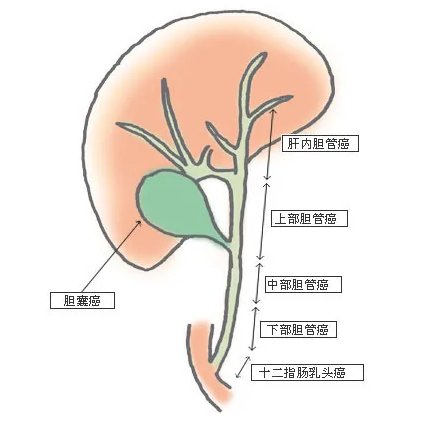 信号|感觉“上火”，可能是癌症信号！