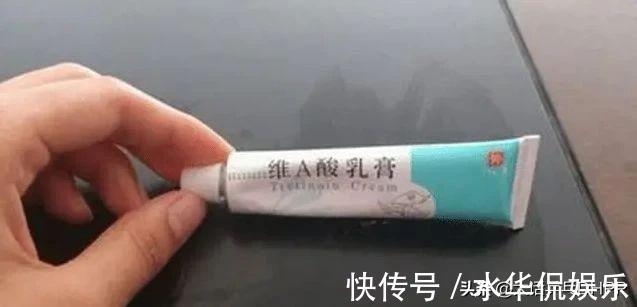 皮肤|在药店里，如果看到这些乳膏，那就有福了！坚持使用会使皮肤变好