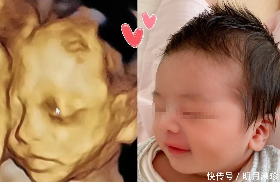 宝妈|有种“暖心”叫胎儿心疼孕妈,用这三种方式默默保护妈妈,感动!