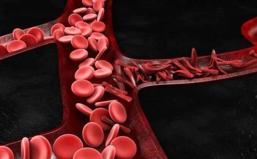 踮起脚尖|每天坚持踮脚尖，5大好处你意想不到，教你3个方法，不妨试试