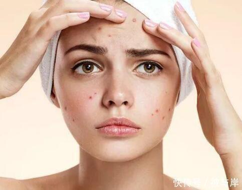 护肤品|去除痘印，用3步就能解决，好用不花钱，用过都说效果好