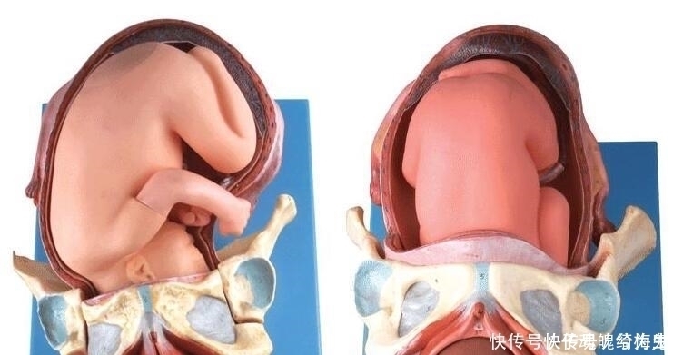 胎儿|别再“埋怨”胎儿了!孕妇辛苦的时候,胎儿也在努力保护妈妈呢