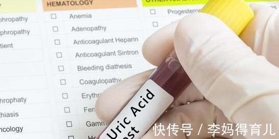 排出体外|高尿酸多喝水管用吗？专家给出的6点建议，让你巧妙喝水降尿酸