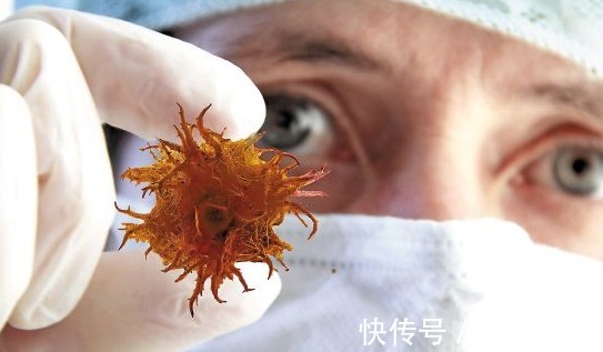 硒食物|癌症也有“杀手锏”,3种“硒食物”每天吃点,远离癌症更长寿