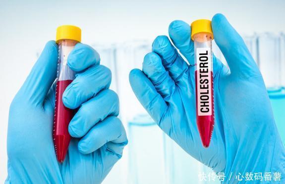 回归|降脂“冠军”公布,并不是洋葱,若你爱吃,甘油三酯慢慢回归正常