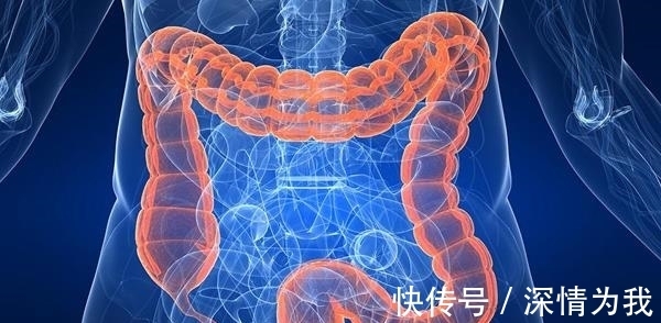 大便|患直肠癌前，身体可能发出这4种“求救信号”，别犹豫及时就医