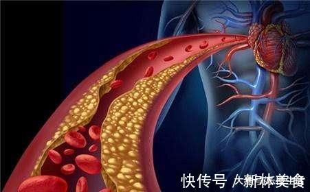 共享单车|身体如果出现这几种表现, 说明你体内的血脂已经快爆表了!