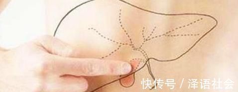 红痣|身上突然长了很多小红痣，是什么原因？其中1个需警惕，不可忽视