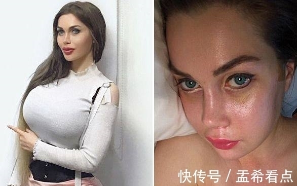 整形手术 美国一女子去韩国做危险极高的额骨手术，还说整容上瘾