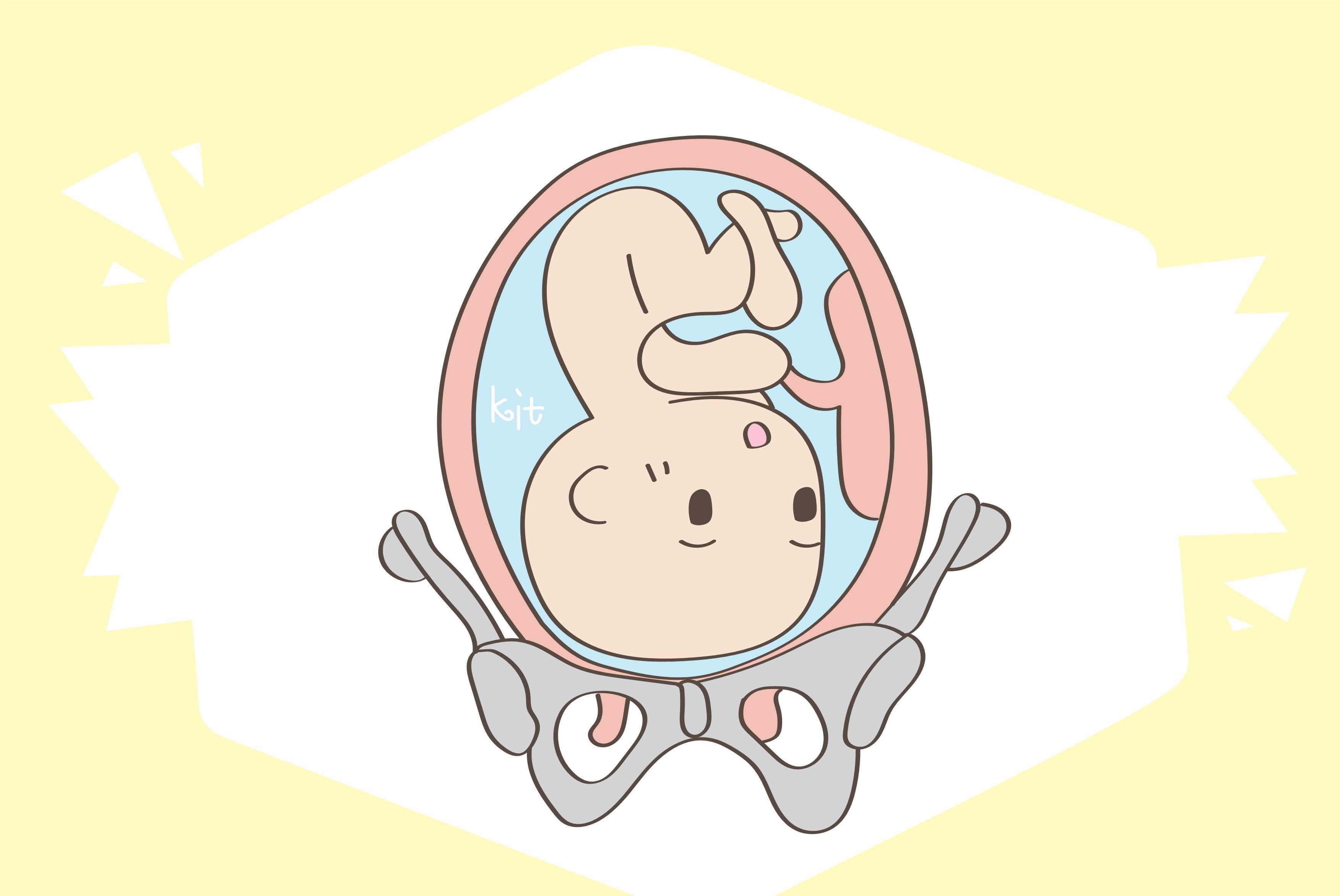 宫缩|宝宝头型不正会影响形象,找出背后原因,及时修正来得及