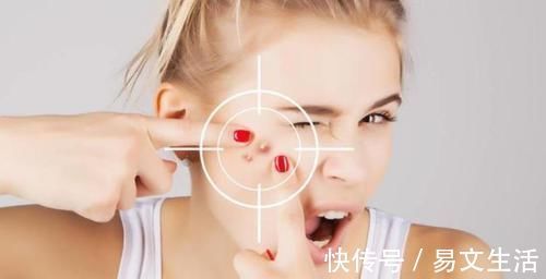 痘痘|痘痘，用什么药效果好？可以尝试用5种药！