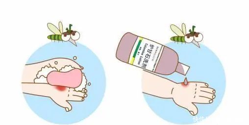 避蚊胺|被蚊虫叮咬后，这样处理，止痒消肿还不起包！亲测有效