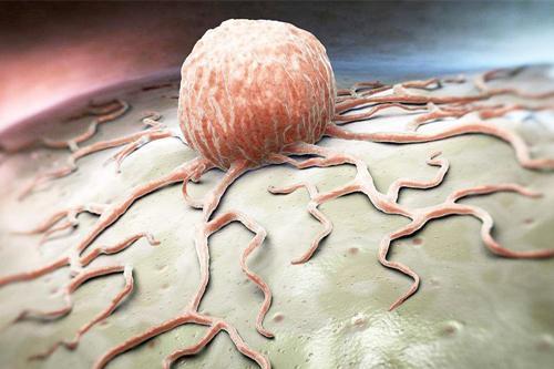 特征|看脸就知道是不是肿瘤体质面部有这些特征,需要引起重视